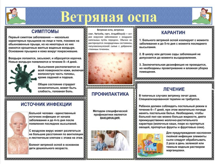 Ветряная оспа. Ветряная оспа.