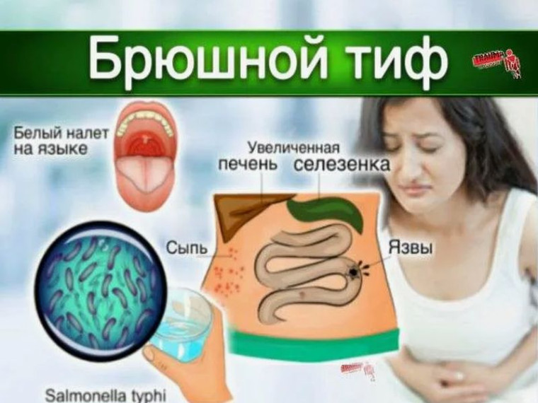 Профилактика брюшного тифа. Профилактика брюшного тифа.